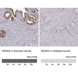 Semenogelin II Antibody, Novus Biologicals 25 &mu;L, Unconjugated:Antibodies,